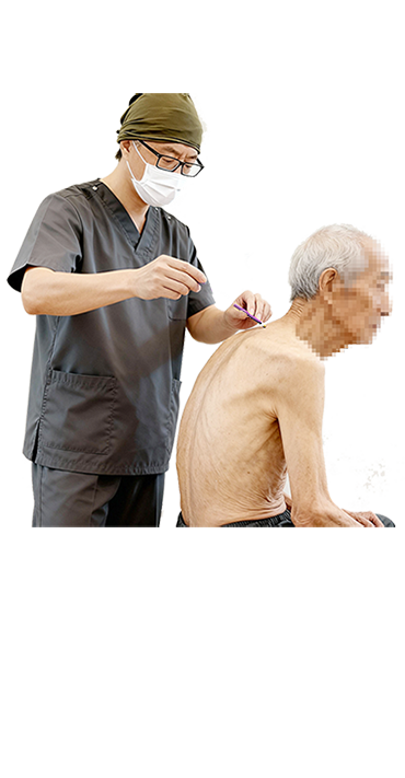 艾绒艾灸麦粒灸米粒灸