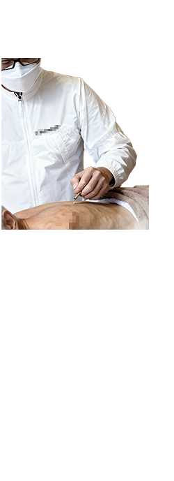 艾绒艾灸麦粒灸米粒灸