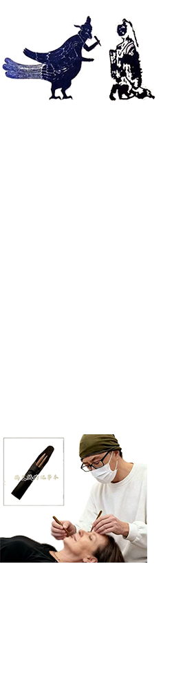 艾绒艾灸麦粒灸米粒灸